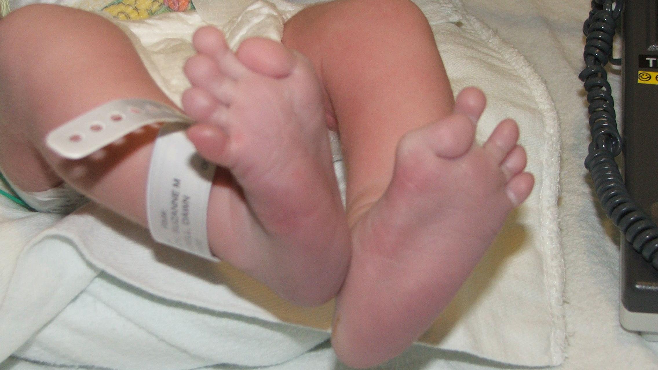 Imagem - Presa no meu corpo: a brasileira com doença genética rara que transforma pessoas em estátuas