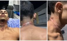 Artur Rios, de 22 anos, voltava de uma entrega na noite dessa quinta (6) quando um fio solto em poste enrolou no pescoço dele e provocou ferimentos graves
