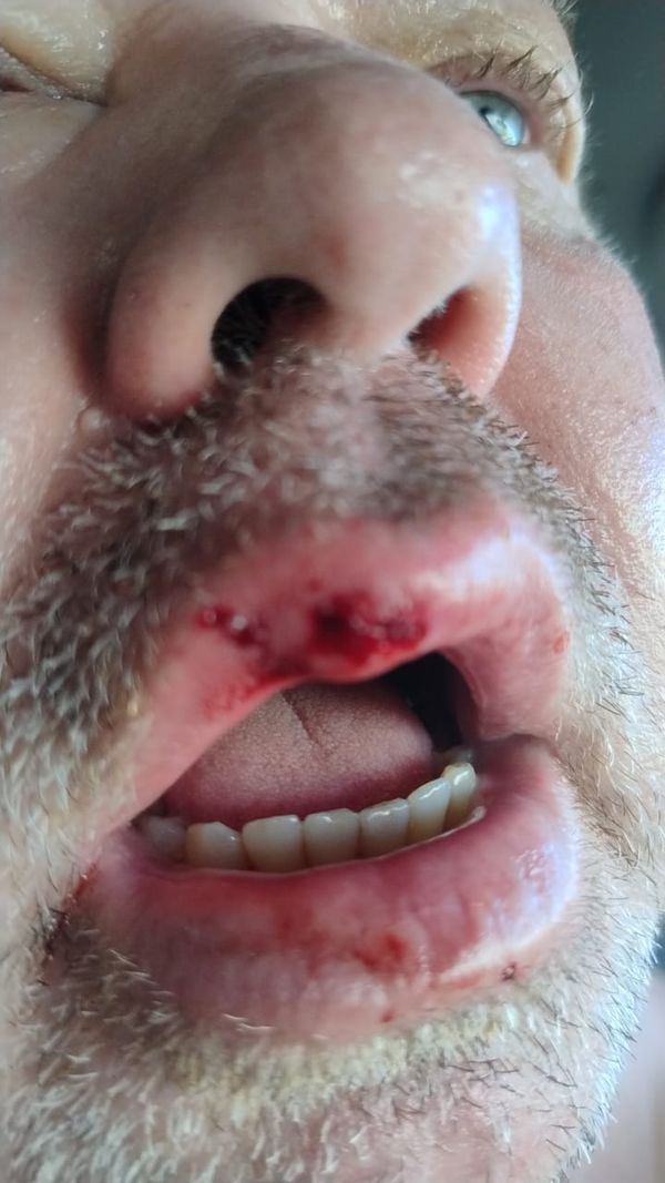 Ataque de pitbulls deixou comerciante ferido em São Mateus  por Reginaldo Rodrigues