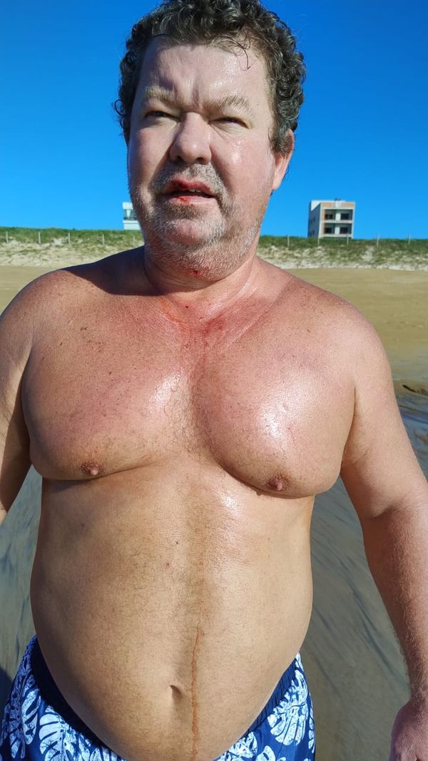 Ataque de pitbulls deixou comerciante ferido em São Mateus  por Reginaldo Rodrigues