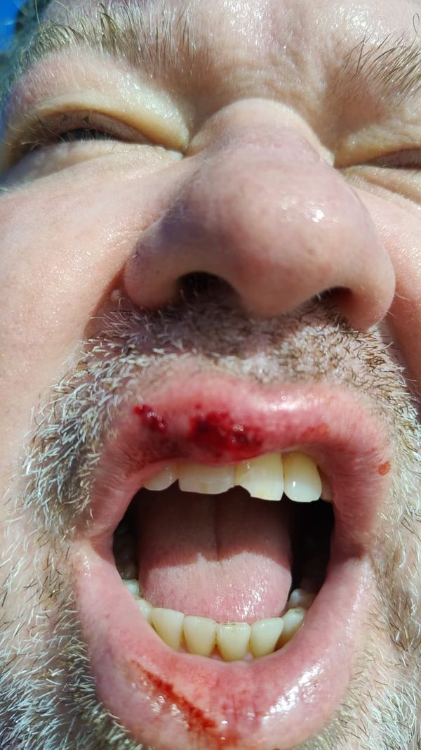 Ataque de pitbulls deixou comerciante ferido em São Mateus  por Reginaldo Rodrigues