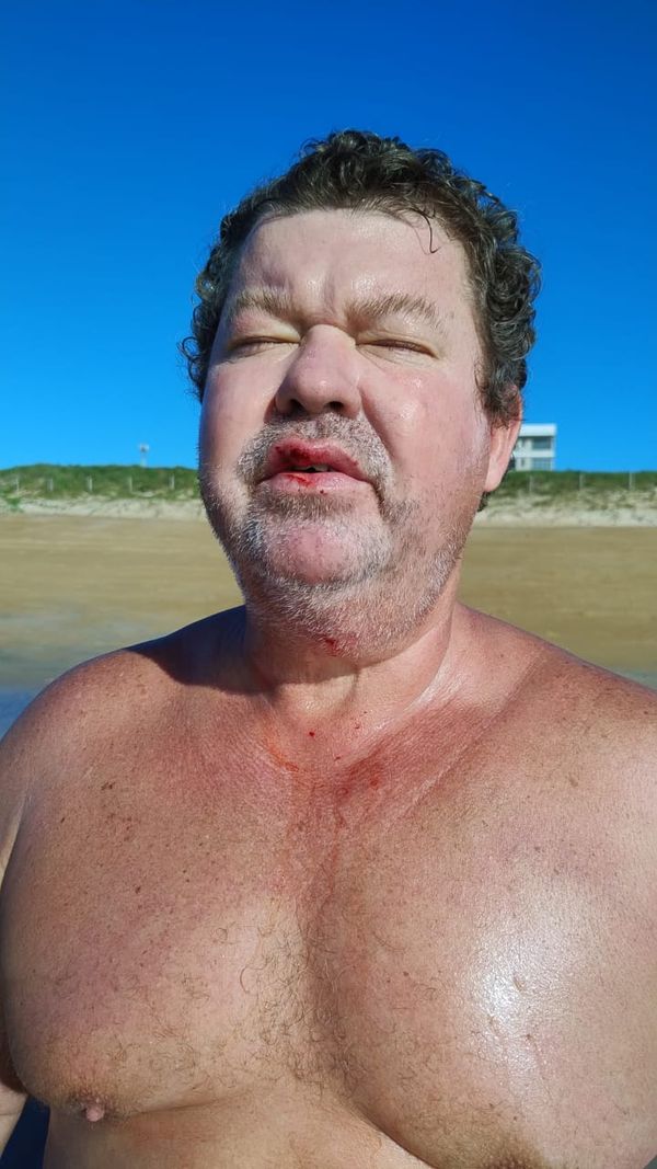 Ataque de pitbulls deixou comerciante ferido em São Mateus  por Reginaldo Rodrigues