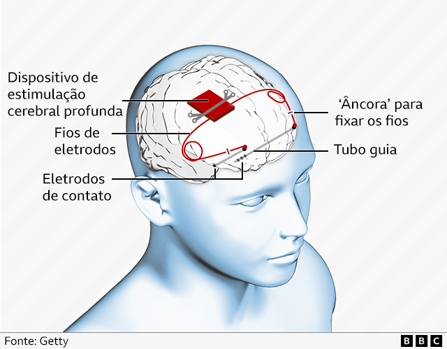 Imagem BBC Brasil