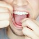 Imagem - Fio ou fita dental: qual a diferença e como decidir entre um e outro?