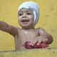Imagem - Menino que teve 60% do corpo queimado esbanja alegria após receber alta