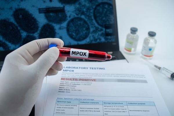 mpox