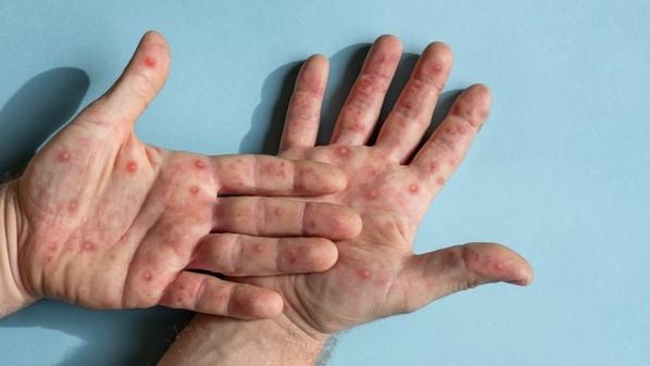 CBN Vitória - bxthddg531g