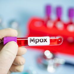 A doença se espalha pelo Brasil, segundo o Ministério da Saúde. Maior concentração de casos está em São Paulo