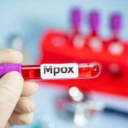 Caso foi registrado em Colatina, município da Região Noroeste; Brasil soma 88 confirmações neste ano, segundo o Ministério da Saúde