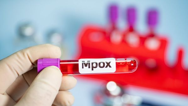 Caso foi registrado em Colatina, município da Região Noroeste; Brasil soma 88 confirmações neste ano, segundo o Ministério da Saúde