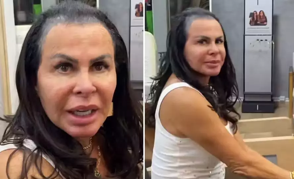 Gretchen surge sem prótese capilar e revela que 'perdeu todo o cabelo'