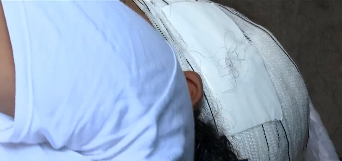 Mulher é agredida com golpes de picareta por vizinho na Serra