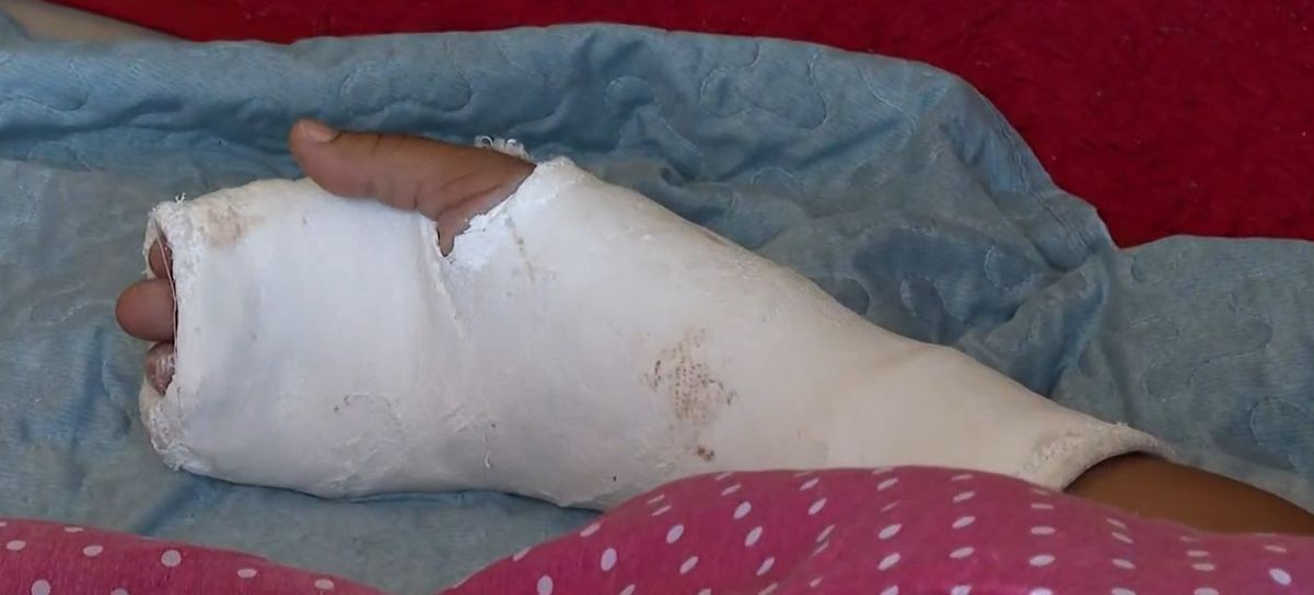 Mulher é agredida com golpes de picareta por vizinho na Serra