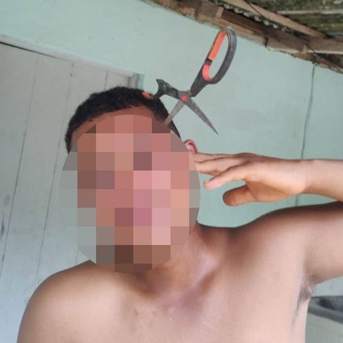 Namorada do adolescente contou que ela estava em uma briga com a irmã, que arremessou a tesoura quando o namorado dela foi intervir