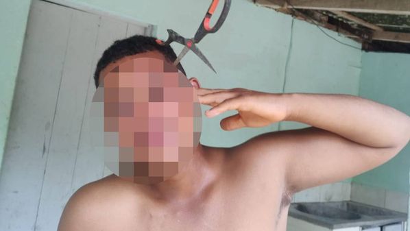 Namorada do adolescente contou que ela estava em uma briga com a irmã, que arremessou a tesoura quando o namorado dela foi intervir