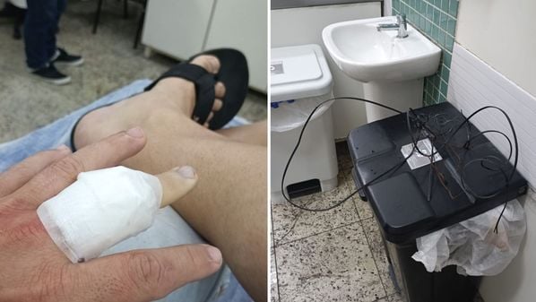 Jonatas Lube, de 38 anos, fazia uma curva, com uma motocicleta, quando a fiação solta ficou enroscada no dedo médio da mão esquerda dele