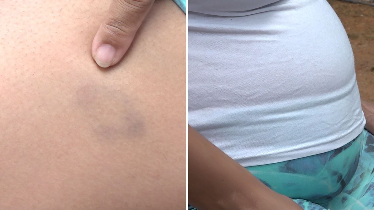 Grávida é espancada por ex-companheiro