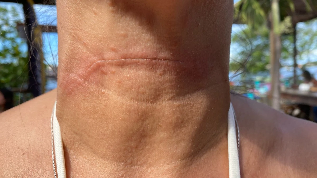 Rejane se feriu enquanto andava de Jet Ski na baía de Vitória