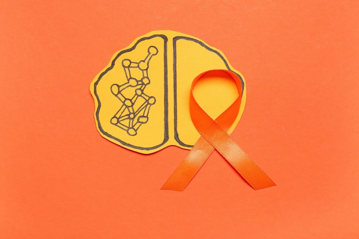 A esclerose múltipla afeta o sistema nervoso central (Imagem: Pixel-Shot | Shutterstock)