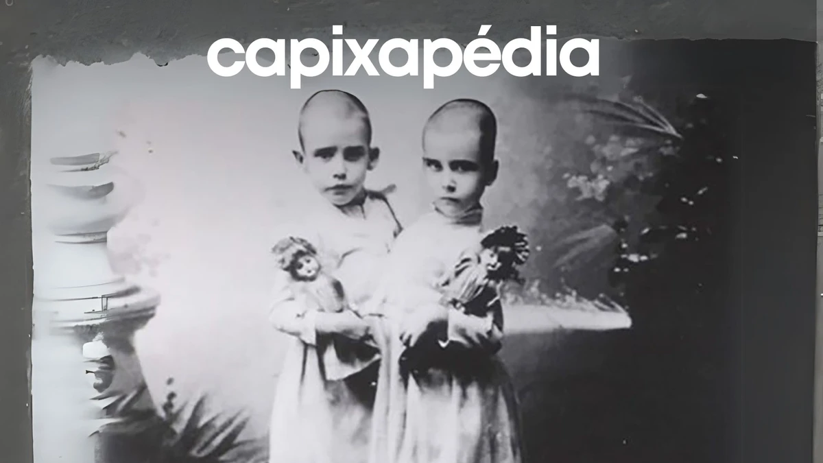 Fotos de 1900 mostram a cirurgia feira por Eduardo Chapot Prévost 