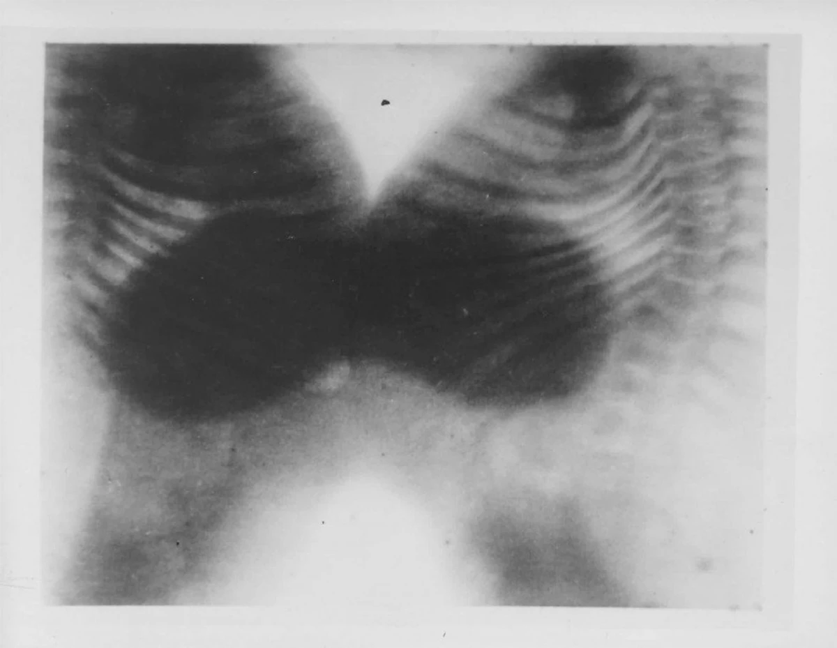 Fotos de 1900 mostram a cirurgia feira por Eduardo Chapot Prévost