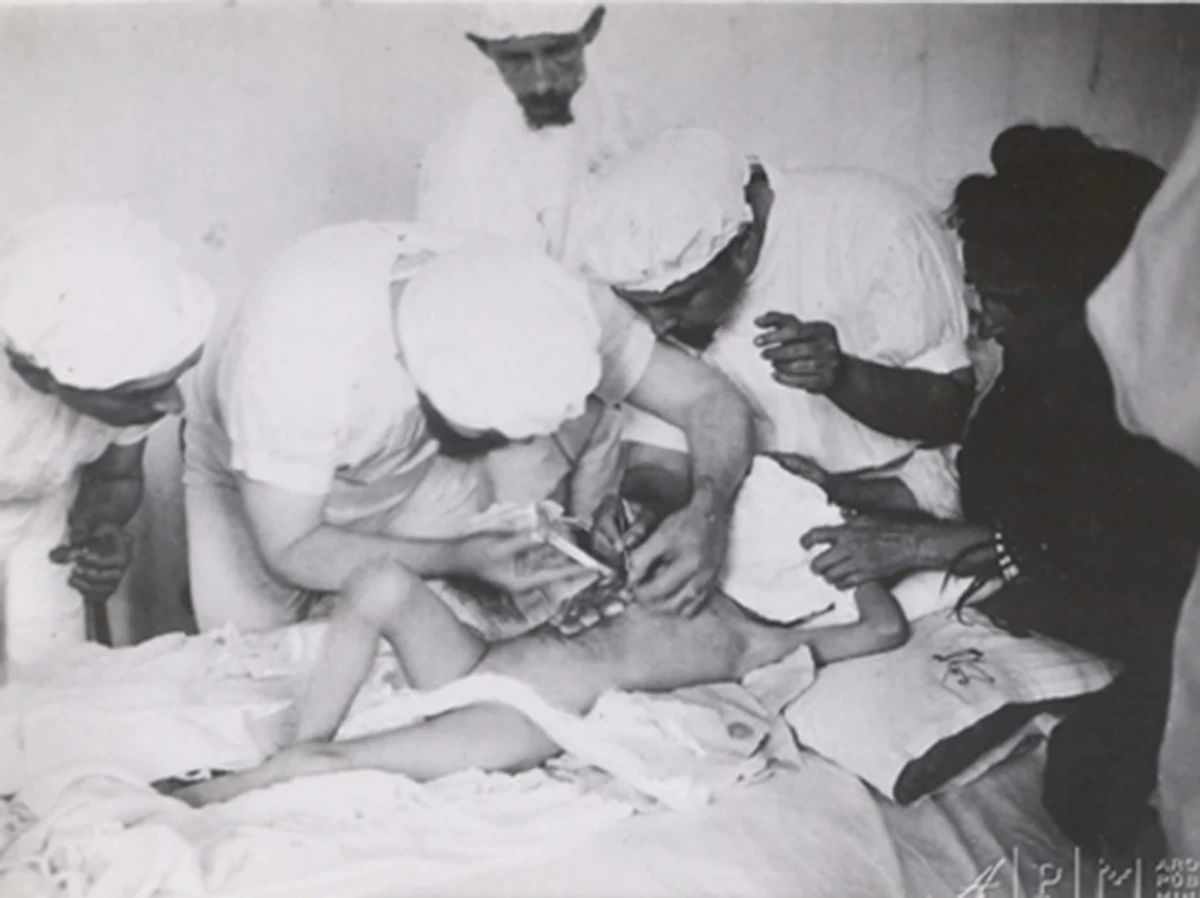 Fotos de 1900 mostram a cirurgia feira por Eduardo Chapot Prévost