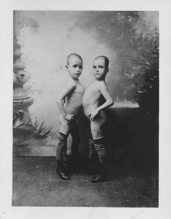 Fotos de 1900 mostram as gêmeas siamesas por Reprodução / Arquivo Público Mineiro / A. Larrete