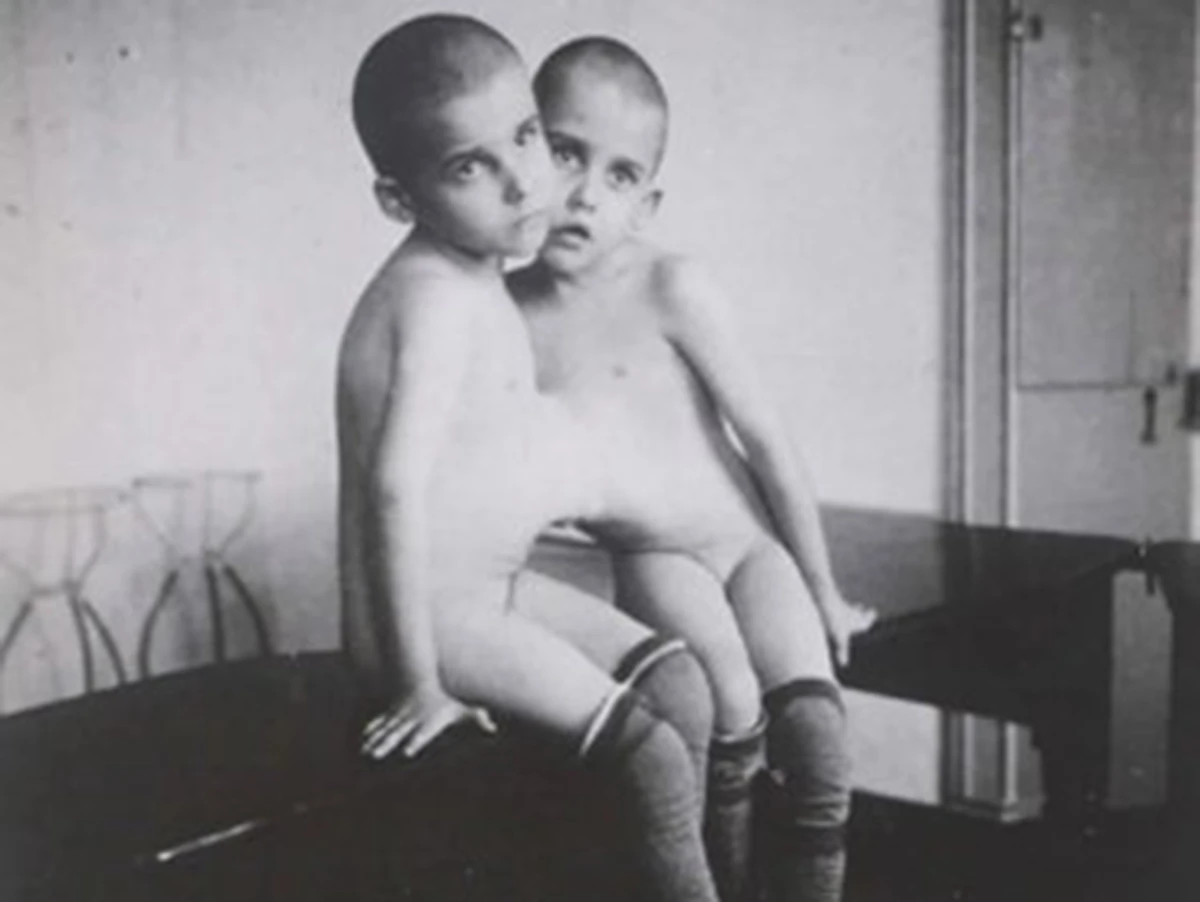 Fotos de 1900 mostram as gêmeas siamesas por Reprodução / Arquivo Público Mineiro / A. Larrete