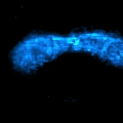 A pesquisa utilizou uma técnica chamada microscopia de folha de luz em um modelo de camundongo geneticamente modificado