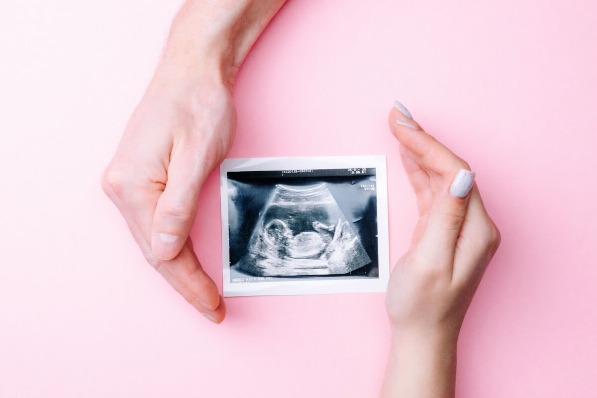 O aborto de repetição acontece quando a mulher sofre três perdas seguidas (Imagem: MVelishchuk | Shutterstock)
