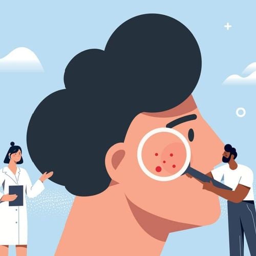 Imagem - Veja sinais para identificar o câncer de pele