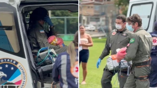 A criança sofreu queimaduras no tórax, lateral frontal e braço esquerdo, totalizando cerca de 27% do corpo