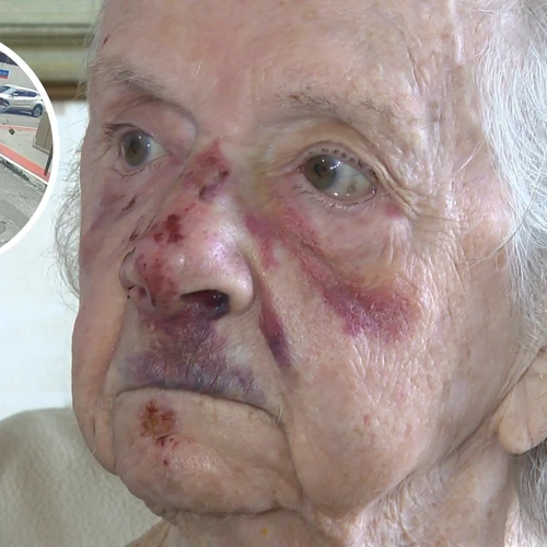 Imagem - 'Que Deus dê a sentença a ele', diz idosa derrubada por ladrão em Vitória