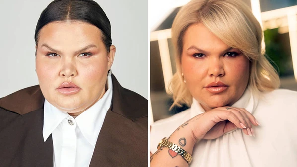 Dançarina, que chegou aos 170 kg antes de fazer a cirurgia bariátrica, também reclamou dos ataques de ódio e criticou Paulo Gustavo: 'Ele era gordofóbico'