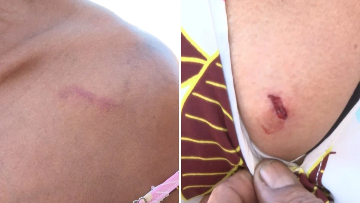 Ferimentos no ombro e no peito, causados pelo marido