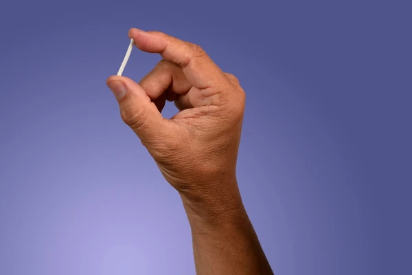  Implanon, implante anticoncepcional