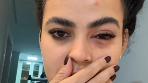 Larissa de Jesus dos Santos, de 27 anos, contou que o inseto entrou no olho dela, enquanto se preparava para tomar banho