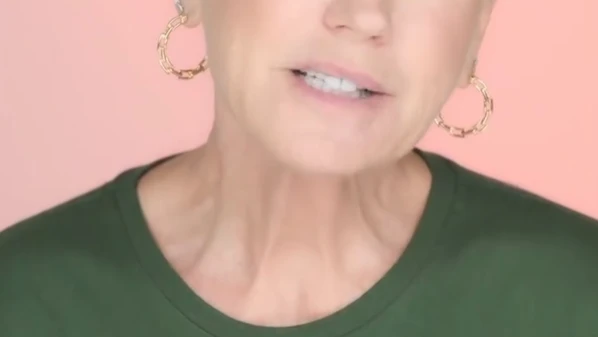 Embora mais conhecida entre os homens, a famosa calvície também afeta muitas mulheres e tem tratamento