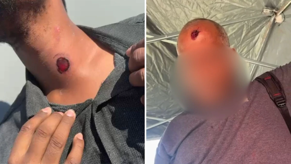 Pelo menos duas pessoas ficaram feridas após PM dar tiros de borracha em manifestação