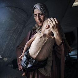 Ahmed al-Arini, fotógrafo em Gaza, diz que capturou as fotos angustiantes para 'mostrar ao resto do mundo a fome extrema' que bebês e crianças estão enfrentando no território palestino.