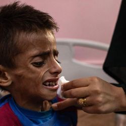 Apesar da gravidade, o novo alerta não representa uma declaração formal de fome em Gaza
