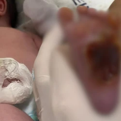 Segundo  Sara Peisino Barboza, mãe de José, o bebê não corre mais risco de morte e vai passar por nova cirurgia na segunda-feira (25)
