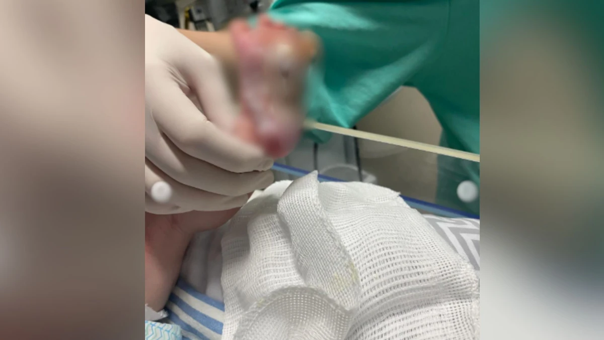 O bebê José, com um dia de vida, teve os pés queimados após uma técnica usada por enfermeira, segundo familiares