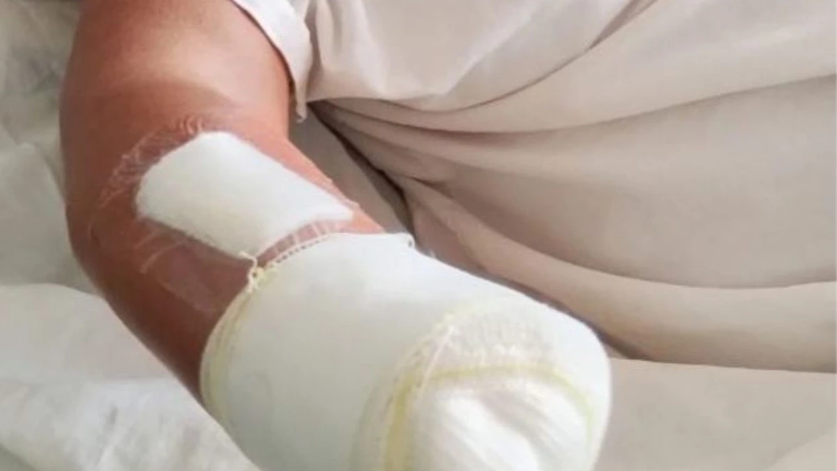 Vítima teve uma das mãos amputadas após o crime, cometido pelo marido