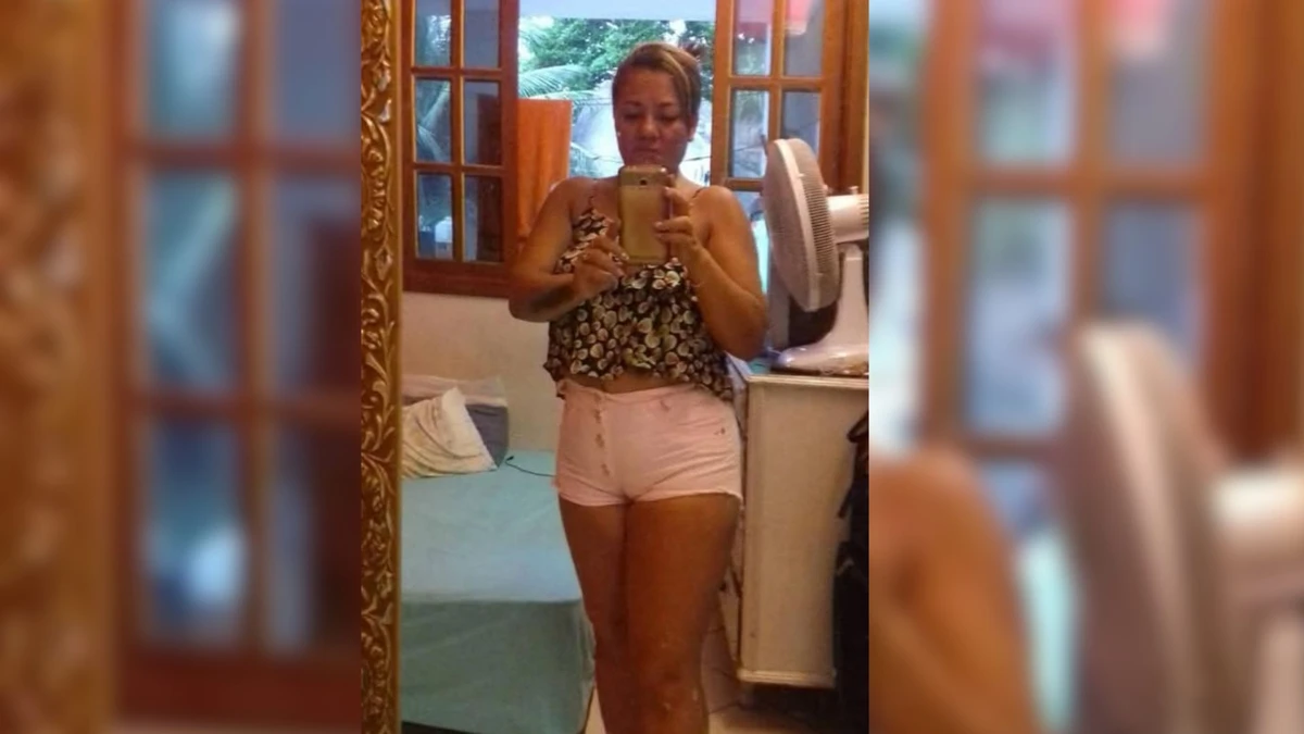 Maria Aparecida Moreira de Souza, de 41 anos, morreu com graves queimaduras no corpo