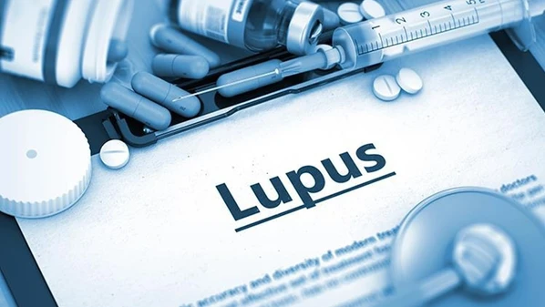 Os medicamentos que vão ser cobertos pelos planos de saúde são o anifrolumabe e o belimumabe