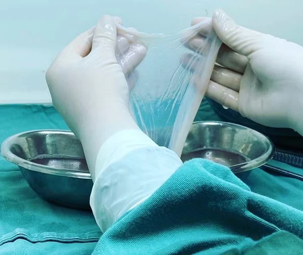 Membrana amniótica coletada na hora do parto será usada em queimaduras — Foto: Divulgação/SantaCasaPOA