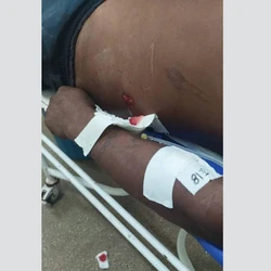 Existe o temor de que possam ocorrer protestos violentos, com destruição de equipamentos públicos, como ocorreu no fim de 2013 em decorrência ao assassinato de três homens por indígenas tenharins, dentro da terra indígena