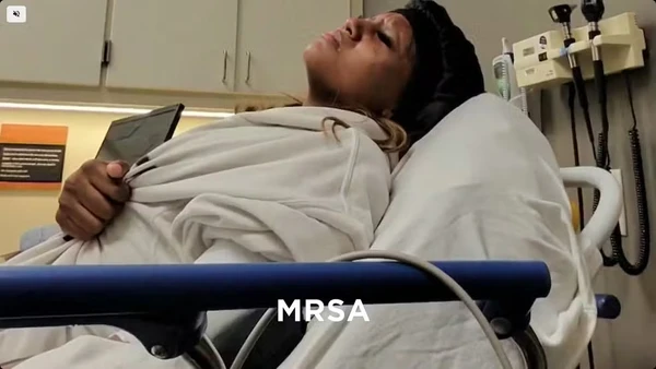 Alexis William foi contaminada por uma bactéria depois de mergulhar na piscina de um hotel