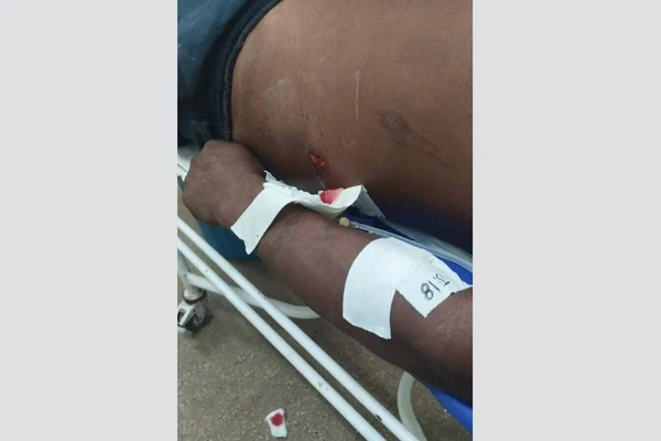 Indígena é ferido em protesto, no Amazonas